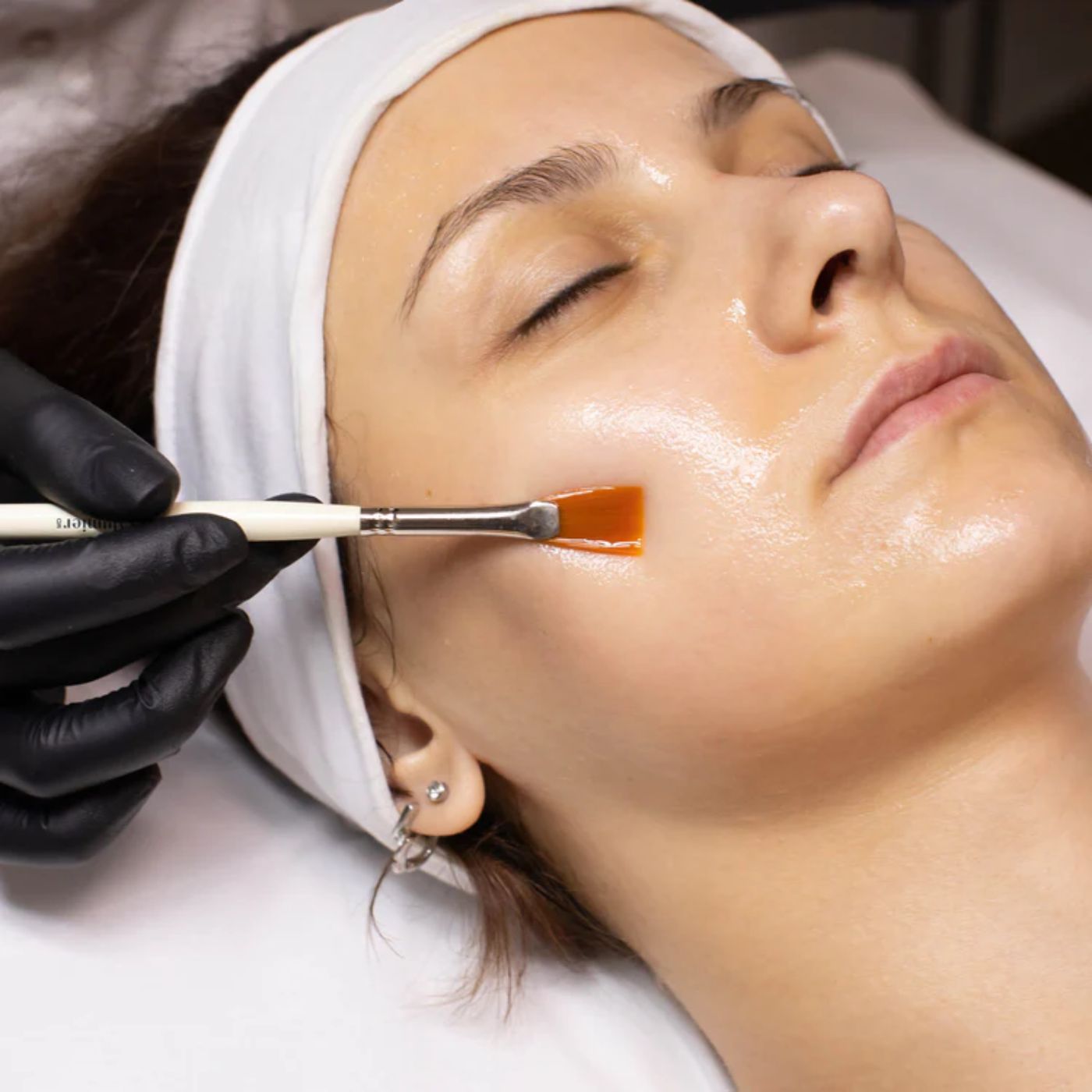 AlumierMD Chemical Peels